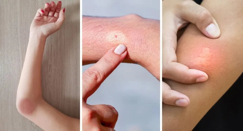 owady podobne do os i szerszeni insektstop.pl